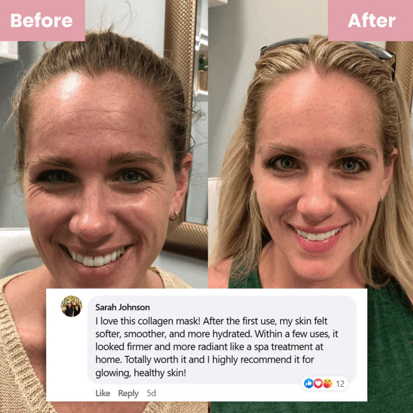 Ivori™  Overnight Collagen Mask