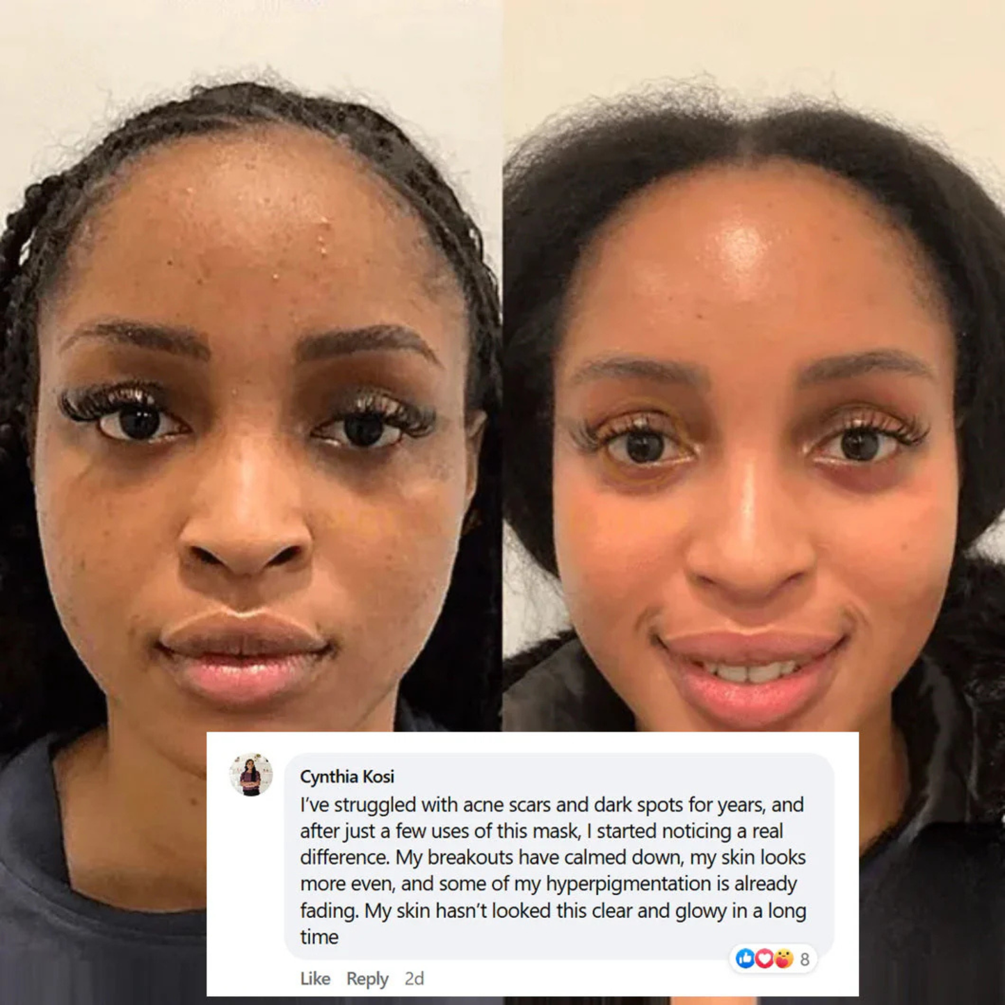 Ivori™  Overnight Collagen Mask