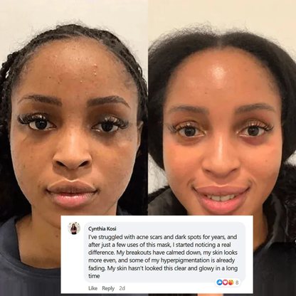 Ivori™  Overnight Collagen Mask